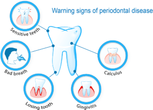 Complete-Smile-dental-The-Gap-tooth-problem-warning-sign-of-periodontal-disease