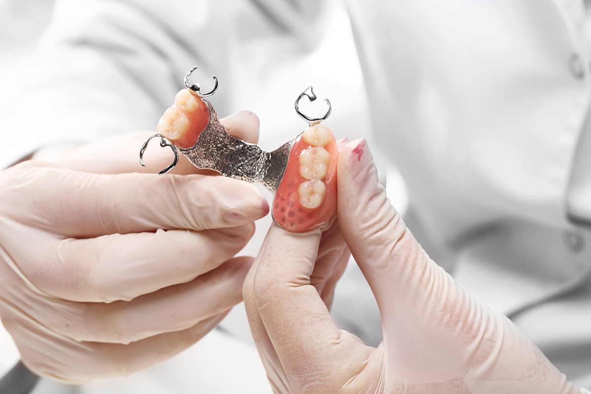 Complete-dental-works-removable-partial-denture