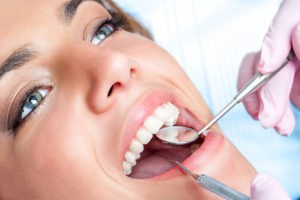 complete-smile-dental-in-chair-tooth-whitening-Brisbane