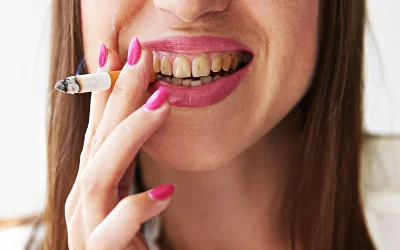Modern treatments for every type of tooth discolouration