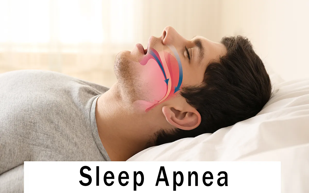 sleep apnoea